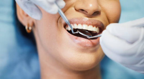 Best Weekend Emergency Dentist in Bluffton, IN